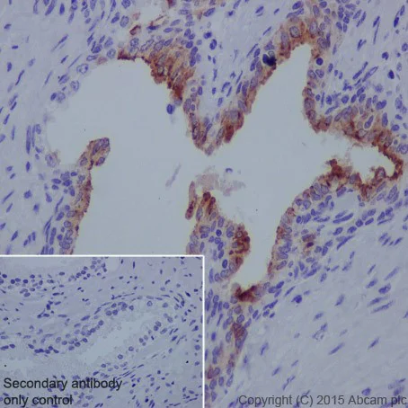 Immunohistochemistry (Formalin/PFA-fixed paraffin-embedded sections) - Anti-MMP7 antibody [EPR17888-101] - BSA and Azide free (AB240369)