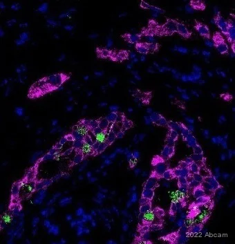 Immunohistochemistry (Formalin/PFA-fixed paraffin-embedded sections) - Anti-MMP7 antibody [EPR17888-71] - BSA and Azide free (AB271977)