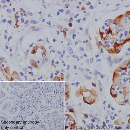 Immunohistochemistry (Formalin/PFA-fixed paraffin-embedded sections) - Anti-MMP7 antibody [EPR17888-71] - Low endotoxin, Azide free (AB226005)
