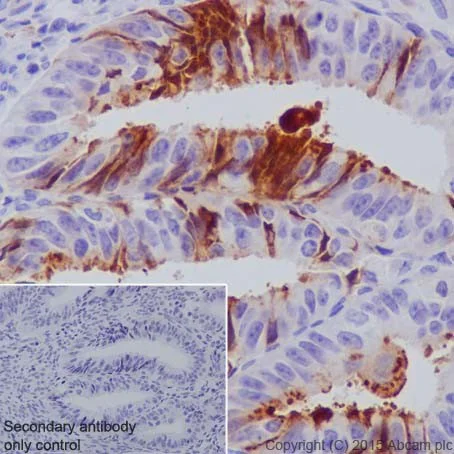 Immunohistochemistry (Formalin/PFA-fixed paraffin-embedded sections) - Anti-MMP7 antibody [EPR17888-71] - Low endotoxin, Azide free (AB226005)