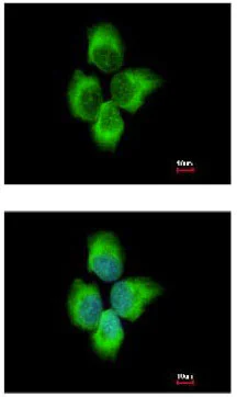 Immunocytochemistry/ Immunofluorescence - Anti-MMP8 antibody (AB154507)