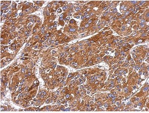Immunohistochemistry (Formalin/PFA-fixed paraffin-embedded sections) - Anti-MMP8 antibody (AB154507), expandable thumbnail