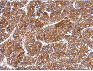 Immunohistochemistry (Formalin/PFA-fixed paraffin-embedded sections) - Anti-MMP8 antibody (AB154507)