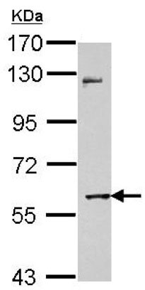 Western blot - Anti-MMP8 antibody (AB154507), expandable thumbnail