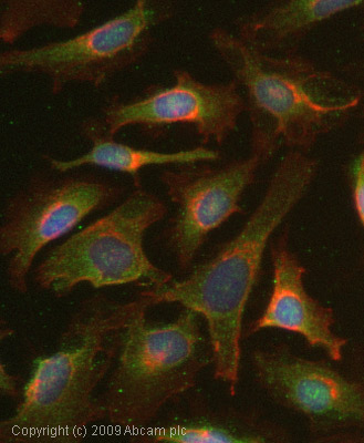 Immunocytochemistry/ Immunofluorescence - Anti-MMP8 antibody (AB53017)