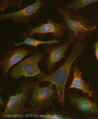 Immunocytochemistry/ Immunofluorescence - Anti-MMP8 antibody (AB53017)