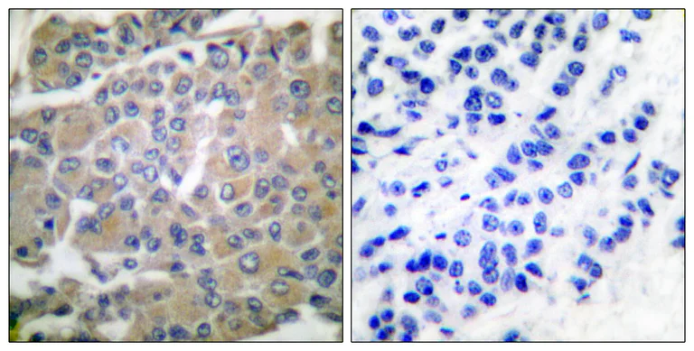 Immunohistochemistry (Formalin/PFA-fixed paraffin-embedded sections) - Anti-MMP8 antibody (AB53017)