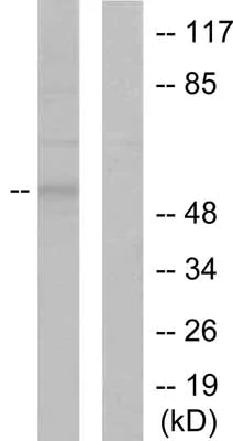 Western blot - Anti-MMP8 antibody (AB53017)