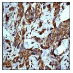 Immunohistochemistry (Formalin/PFA-fixed paraffin-embedded sections) - Anti-MMP8 antibody [EP1252Y] (AB81286)