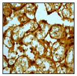 Immunohistochemistry (Formalin/PFA-fixed paraffin-embedded sections) - Anti-MMP8 antibody [EP1252Y] (AB81286), expandable thumbnail