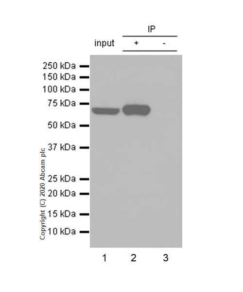 Immunoprecipitation - Anti-MMP8 antibody [EP1252Y] (AB81286), expandable thumbnail