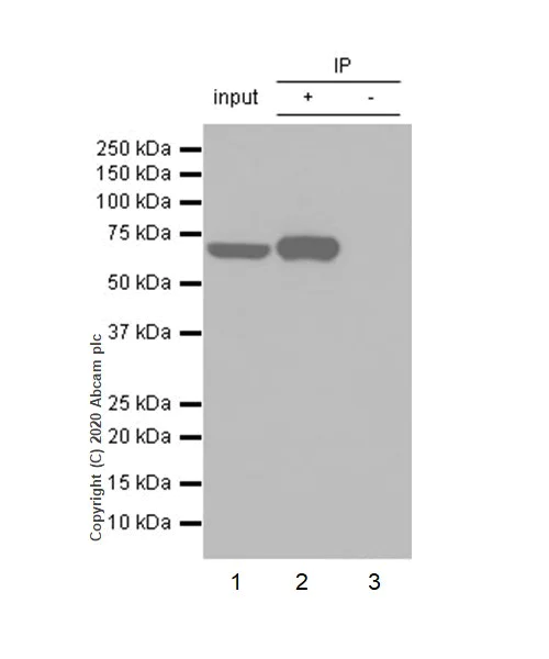 Immunoprecipitation - Anti-MMP8 antibody [EP1252Y] (AB81286)