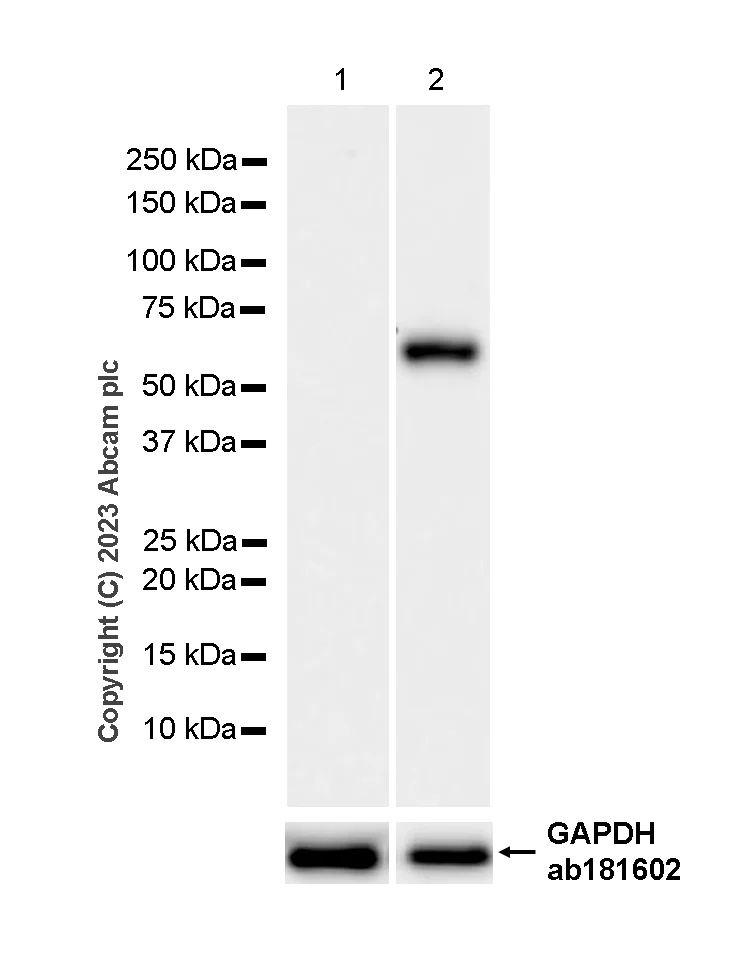 Western blot - Anti-MMP8 antibody [EP1252Y] (AB81286)