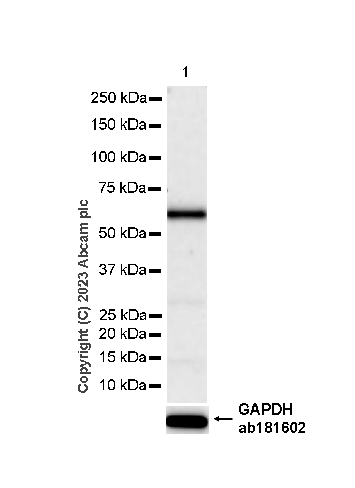Western blot - Anti-MMP8 antibody [EP1252Y] (AB81286), expandable thumbnail