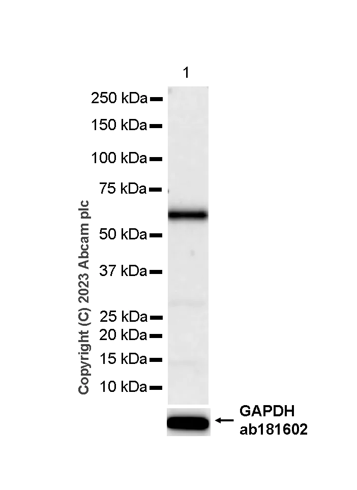 Western blot - Anti-MMP8 antibody [EP1252Y] (AB81286)