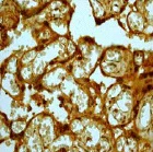 Immunohistochemistry (Formalin/PFA-fixed paraffin-embedded sections) - Anti-MMP8 antibody [EP1252Y] - Low endotoxin, Azide free (AB224265)
