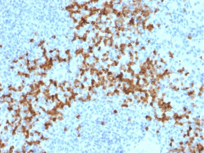 Immunohistochemistry (Formalin/PFA-fixed paraffin-embedded sections) - Anti-MMP9 antibody [2C3] (AB270246)