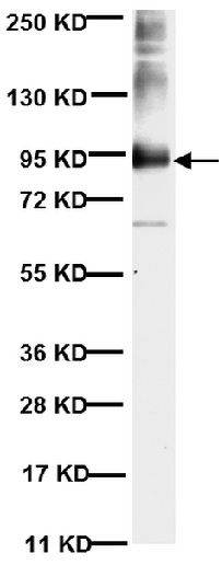 Western blot - Anti-MMP9 antibody [56-2A4] (AB58803), expandable thumbnail