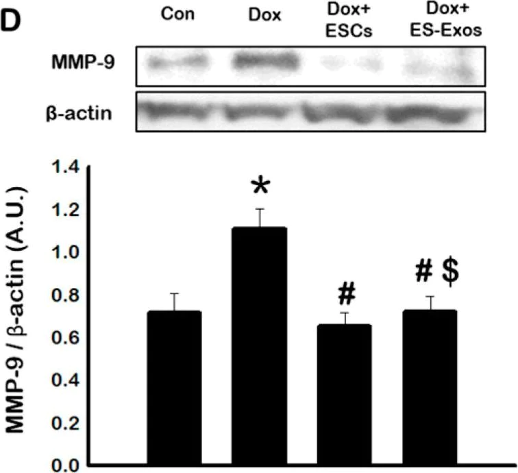 Western blot - Anti-MMP9 antibody (AB38898)