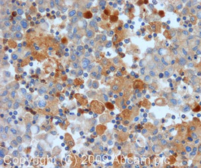 Immunohistochemistry (Formalin/PFA-fixed paraffin-embedded sections) - Anti-MMP9 antibody (AB73734)