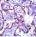 Immunohistochemistry (Formalin/PFA-fixed paraffin-embedded sections) - Anti-MMP9 antibody (AB74277)