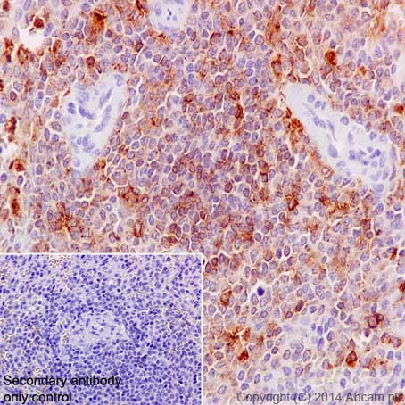 Immunohistochemistry (Formalin/PFA-fixed paraffin-embedded sections) - Anti-MMP9 antibody [EP1254] (ab76003), expandable thumbnail