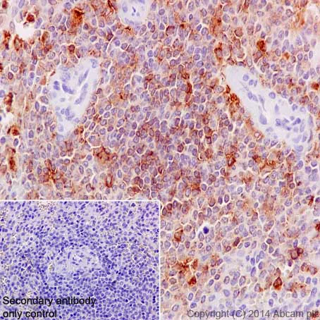 Immunohistochemistry (Formalin/PFA-fixed paraffin-embedded sections) - Anti-MMP9 antibody [EP1254] (AB76003)