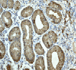 Immunohistochemistry (Formalin/PFA-fixed paraffin-embedded sections) - Anti-MMP9 antibody [EP1254] (ab76003), expandable thumbnail