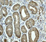 Immunohistochemistry (Formalin/PFA-fixed paraffin-embedded sections) - Anti-MMP9 antibody [EP1254] - BSA and Azide free (AB204850)
