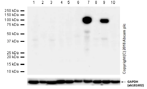 Western blot - Anti-MMP9 antibody [EP1254] - BSA and Azide free (AB204850)