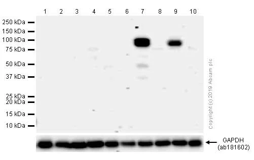 Western blot - Anti-MMP9 antibody [EP1255Y] (AB137867)