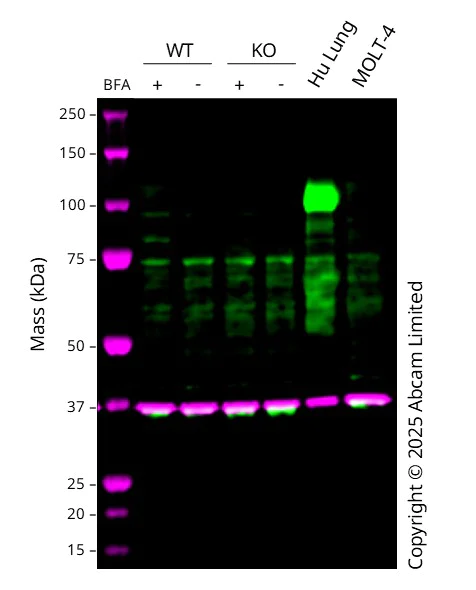 Western blot - Anti-MMP9 antibody [EP1255Y] (AB137867)