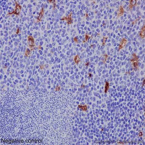 Immunohistochemistry (Formalin/PFA-fixed paraffin-embedded sections) - Anti-MMP9 antibody [EP1255Y] - BSA and Azide free (AB271910)
