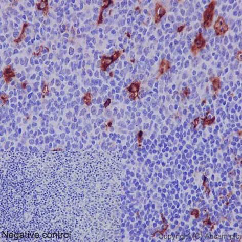 Immunohistochemistry (Formalin/PFA-fixed paraffin-embedded sections) - Anti-MMP9 antibody [EP1255Y] - BSA and Azide free (AB271910)