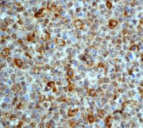 Immunohistochemistry (Formalin/PFA-fixed paraffin-embedded sections) - Anti-MMP9 antibody [EP1255Y] - Low endotoxin, Azide free (AB219372)