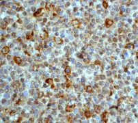 Immunohistochemistry (Formalin/PFA-fixed paraffin-embedded sections) - Anti-MMP9 antibody [EP1255Y] - Low endotoxin, Azide free (AB219372)
