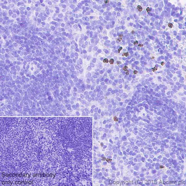 Immunohistochemistry (Formalin/PFA-fixed paraffin-embedded sections) - Anti-MMP9 antibody [EPR22140-154] (AB228402)