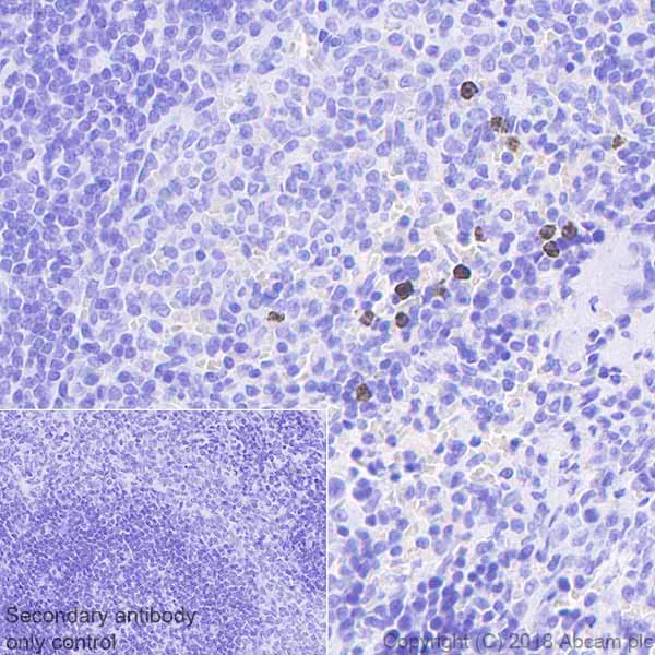 Immunohistochemistry (Formalin/PFA-fixed paraffin-embedded sections) - Anti-MMP9 antibody [EPR22140-154] (AB228402)