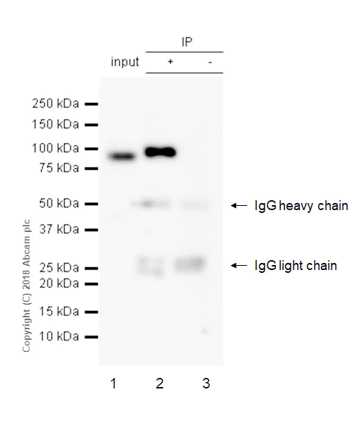 Immunoprecipitation - Anti-MMP9 antibody [EPR22140-154] (AB228402)