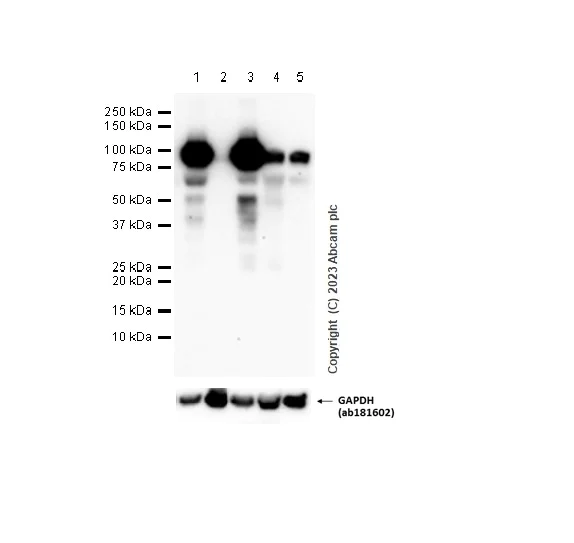 Western blot - Anti-MMP9 antibody [EPR22140-154] (AB228402)