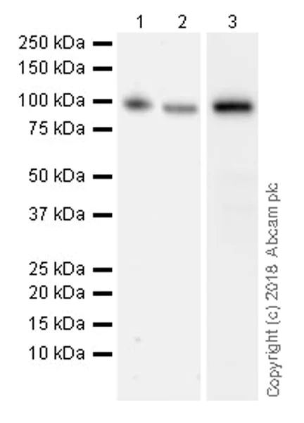 Western blot - Anti-MMP9 antibody [EPR22140-154] (AB228402)