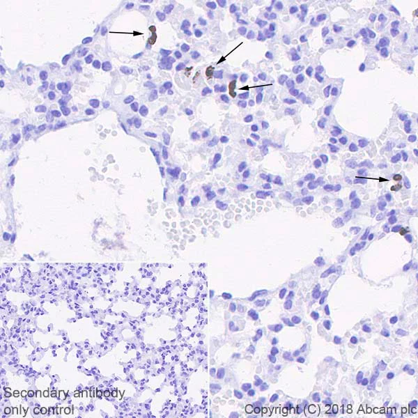 Immunohistochemistry (Formalin/PFA-fixed paraffin-embedded sections) - Anti-MMP9 antibody [EPR22140-154] - BSA and Azide free (AB237782)