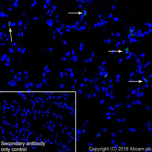 Immunohistochemistry (Frozen sections) - Anti-MMP9 antibody [EPR22140-154] - BSA and Azide free (AB237782)