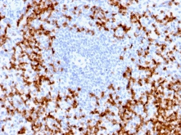 Immunohistochemistry (Formalin/PFA-fixed paraffin-embedded sections) - Anti-MMP9 antibody [MMP9/2025R] (AB236494)
