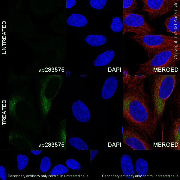 Immunocytochemistry/ Immunofluorescence - Anti-MMP9 antibody [RM1020] (AB283575)