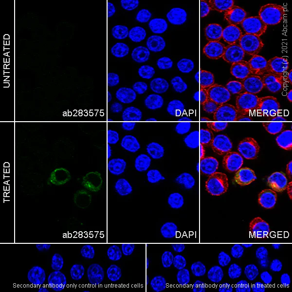 Immunocytochemistry/ Immunofluorescence - Anti-MMP9 antibody [RM1020] (AB283575)