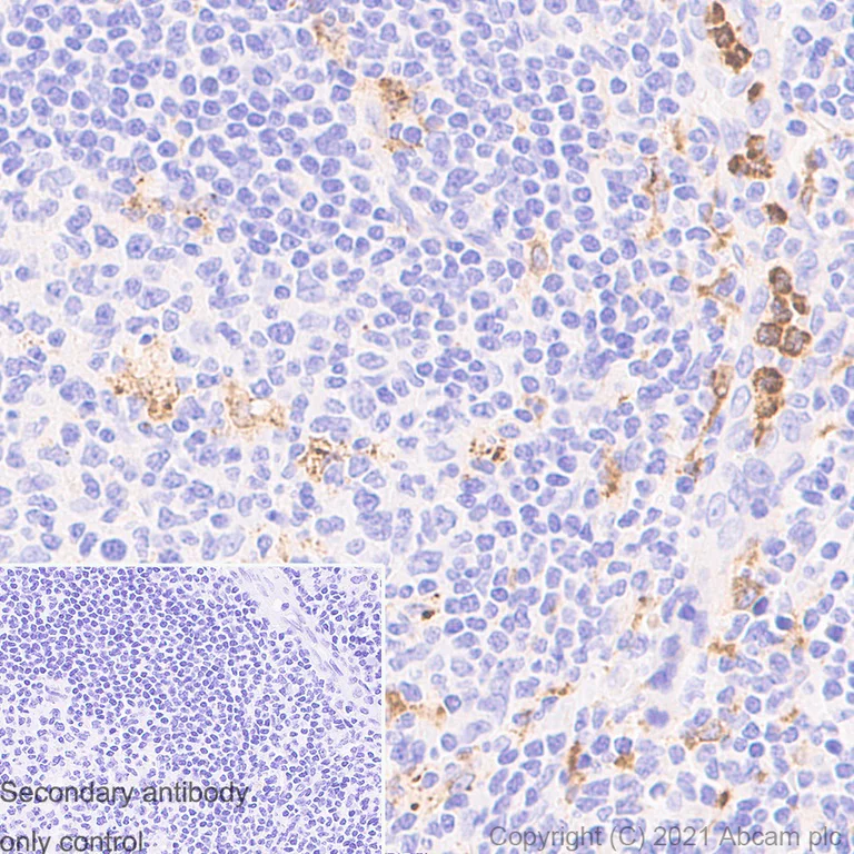 Immunohistochemistry (Formalin/PFA-fixed paraffin-embedded sections) - Anti-MMP9 antibody [RM1020] (AB283575)