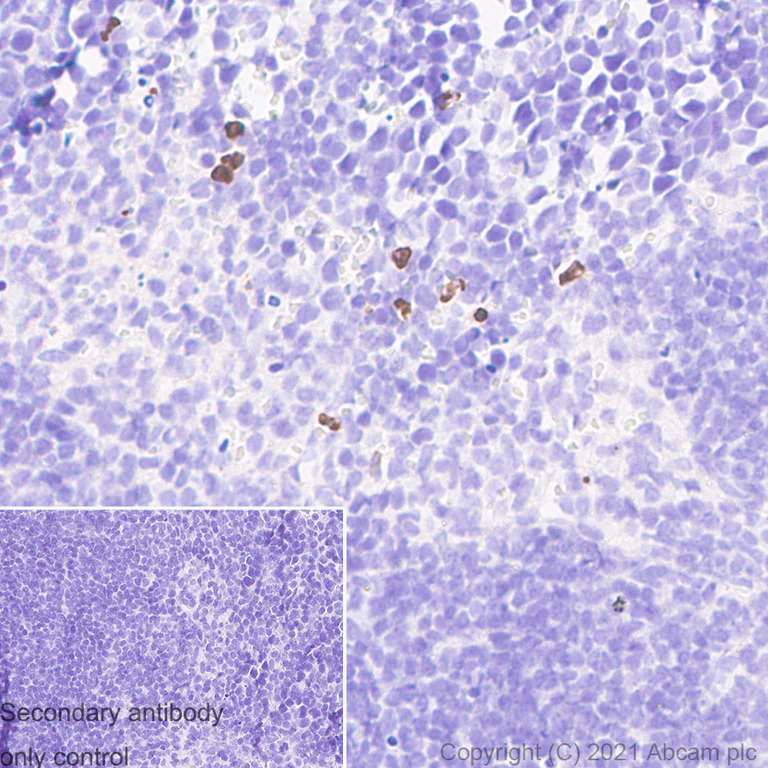 Immunohistochemistry (Formalin/PFA-fixed paraffin-embedded sections) - Anti-MMP9 antibody [RM1020] (AB283575)