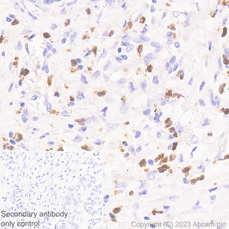 Immunohistochemistry (Formalin/PFA-fixed paraffin-embedded sections) - Anti-MMP9 antibody [RM1020] (AB283575)