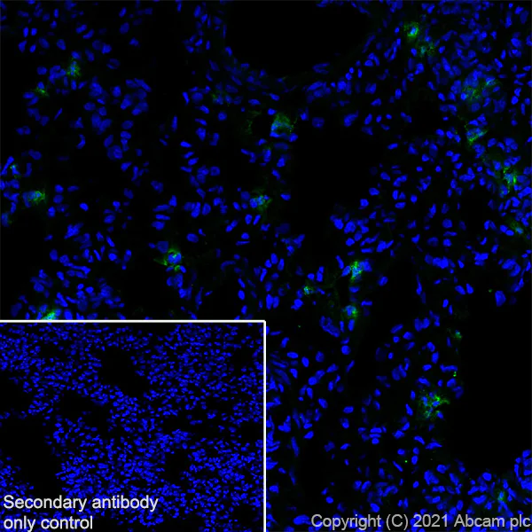 Immunohistochemistry (Frozen sections) - Anti-MMP9 antibody [RM1020] (AB283575)